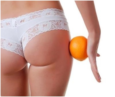 Wie wird Cellulite pro Woche loswerden?? 02