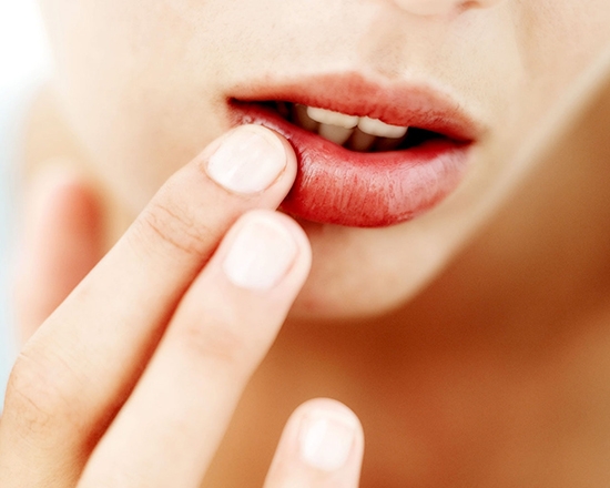 Herpes auf der Lippe während der Schwangerschaft: die Ursachen des Aussehens, mögliche Folgen und Behandlung. Welche Salben können verwendet werden?? 02