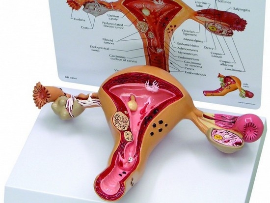 Endometritis: Symptome und Behandlung von Krankheiten in der akuten und chronischen Bühne 01