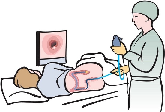 Alames Blut aus dem hinteren Durchgang, wenn er mit Schmerz und ohne Schmerzen defekt ist: Ursachen, Behandlung 04