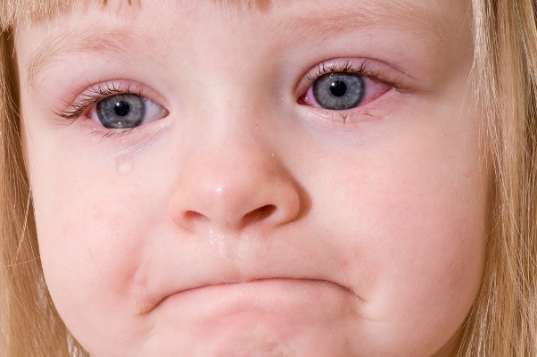 Feine Augen in einem Kind: Gründe. Als umfassende Augen zu behandeln? 01