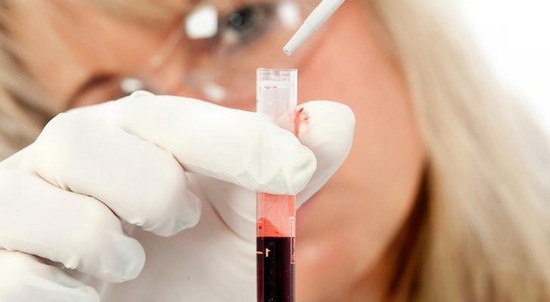 Dickes Blut: Ursachen und Behandlung. Was sind die Symptome einer Pathologie?? 02