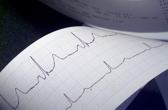 EKG: Entschlüsselung und normale Indikatoren für Menschen unterschiedlicher Alters 03