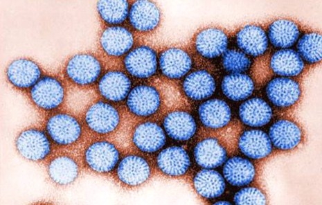 Rotavirus-Infektion: Symptome und Behandlung 02