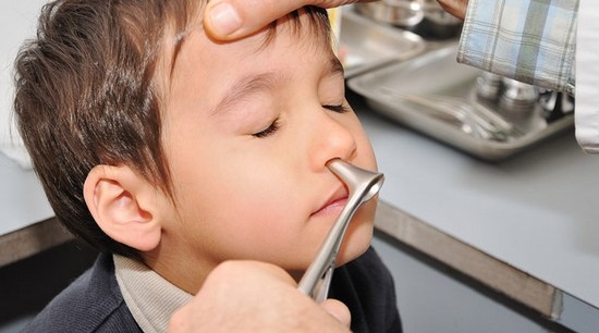 Adenoide in der Nase bei Kindern: Ursachen, Symptome und Behandlung von Krankheiten 03