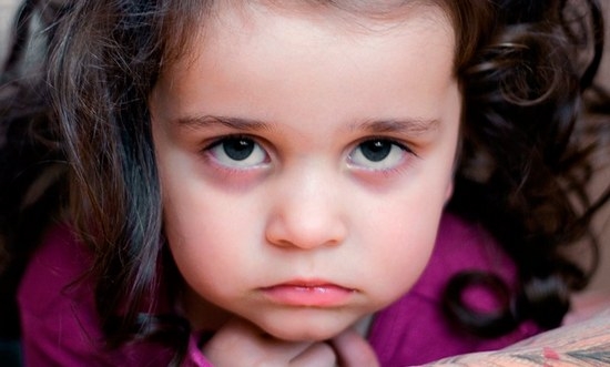 Das Kind erschien Blutergüsse unter den Augen: Ursachen, Behandlungsmethoden 01