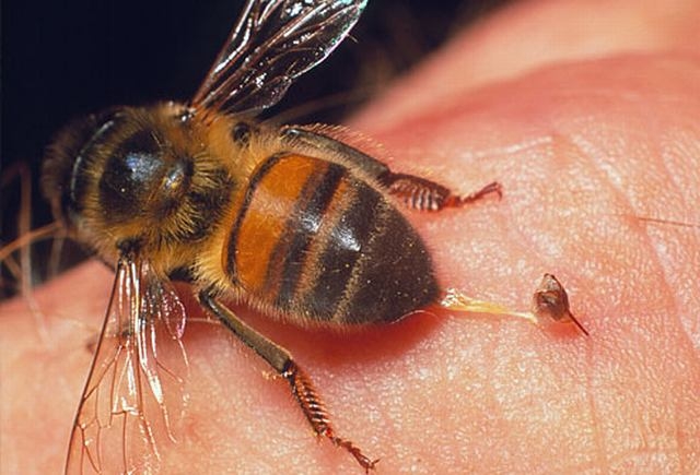 BEE BITE: Folgen. Was tun, wenn der Bienen beißen?? 01