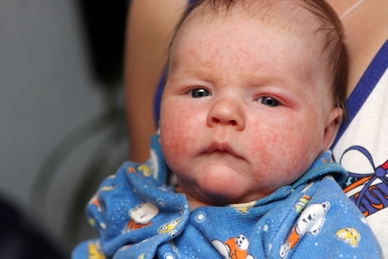 Tropfen Phenyatil für Kinder: Gebrauchsanweisung, Dosierung, Bewertungen 01